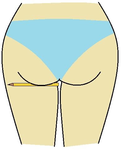 The Pencil Test: if the pencil falls out the muscles are not strong enough to hold the glute up properly.