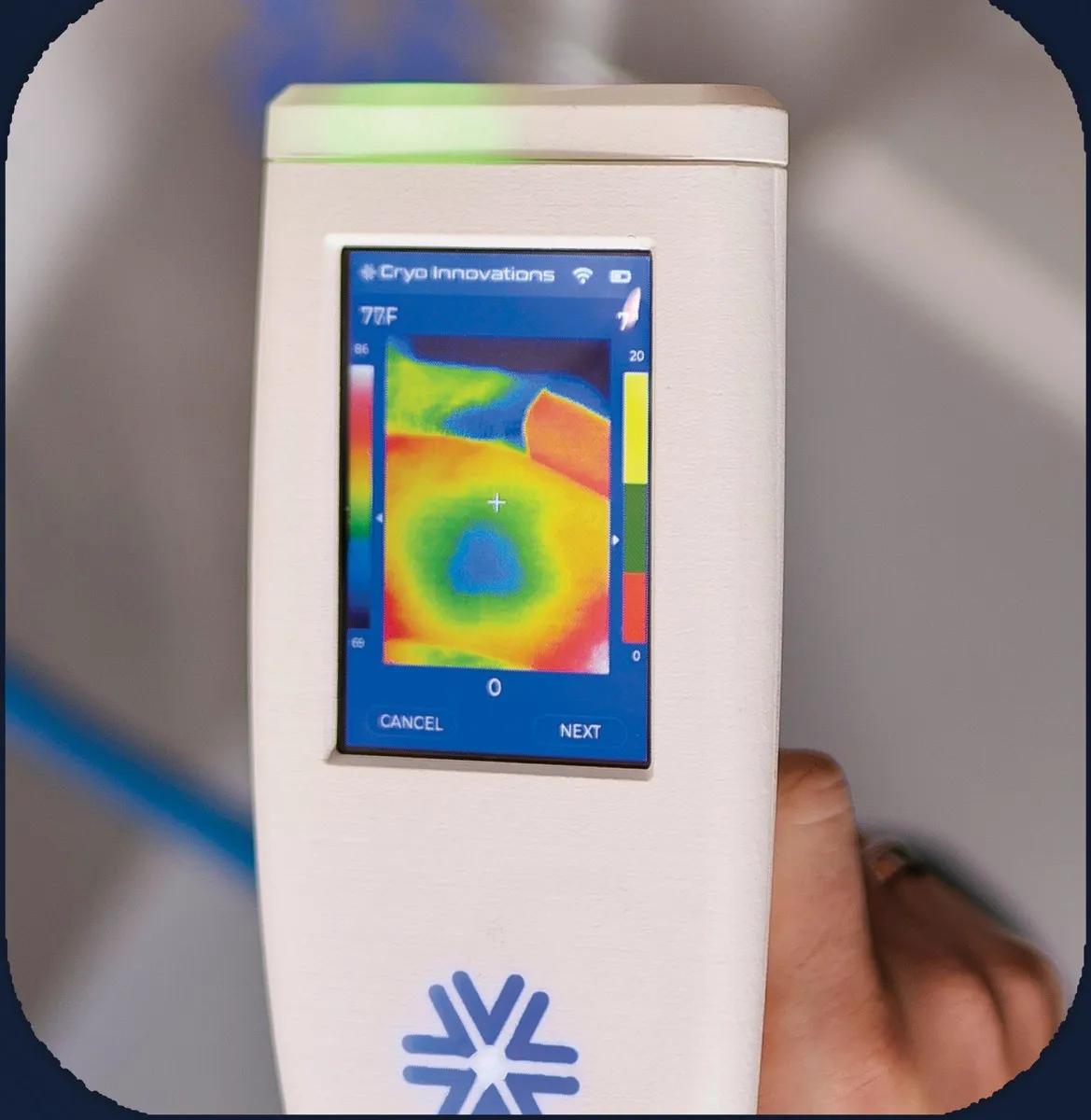 XR ISO thermal imaging view showing skin temperature during treatment